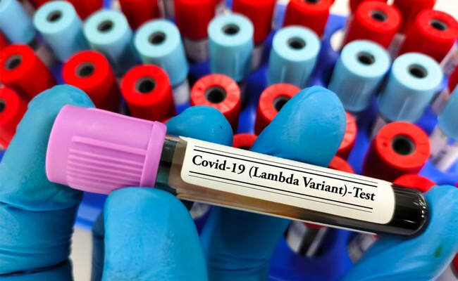 Muncul Covid-19 Varian Lambda, Mirip dengan Delta hingga Diklaim Kebal Vaksin