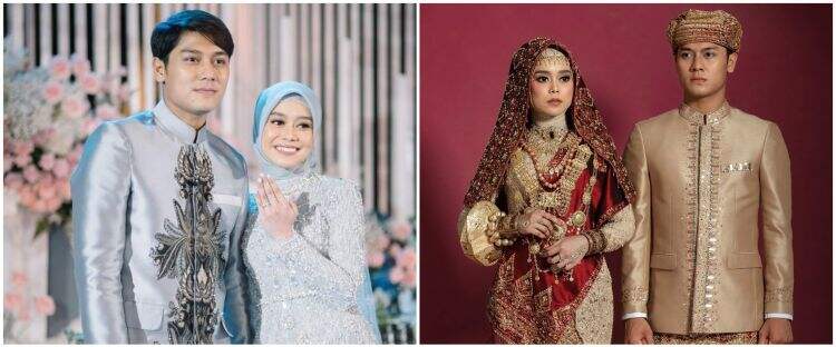 Terlihat Sederhana, Jam Tangan Lesti Kejora Ini Harganya Fantastis