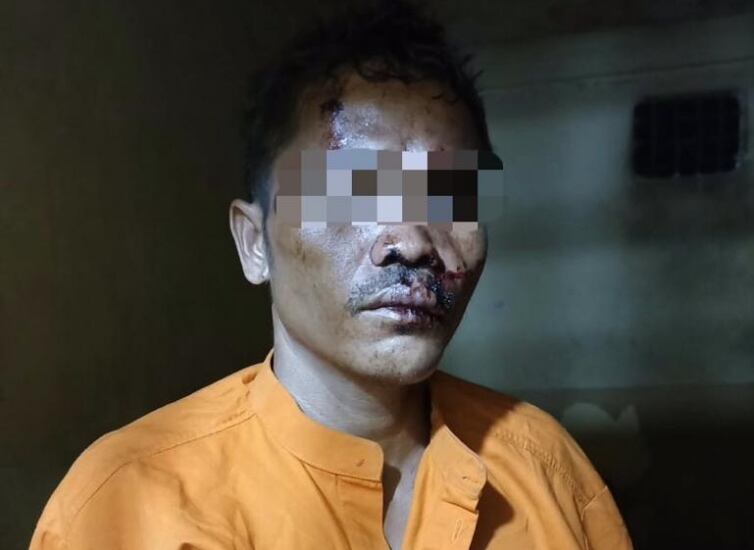 Sadis! Kesal Diminta Air, Pria di Rohul Riau Kapak Bayi 7 Bulan hingga Tewas