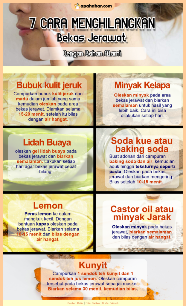 INFOGRAFIS: Cara Menghilangkan Bekas Jerawat