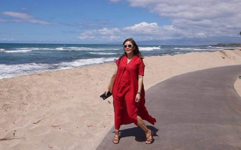Maia Estianty Cuek Kulit Terkena Sinar Matahari Meski Idap Rosacea: Bodo Ah