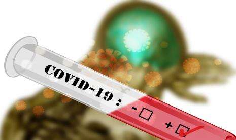 Kasus Positif Pekan Ini Turun 34,6 Persen