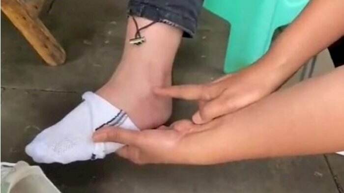 Dipaksa 150 Squat sebagai Hukuman oleh Gurunya, Gadis Remaja Ini Cacat Permanen