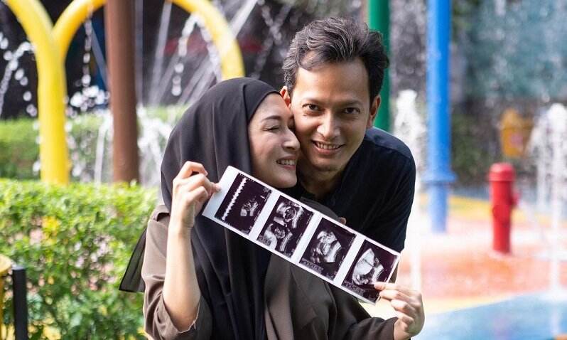 Istri Hamil Anak Ketiga, Fedi Nuril: Alat Kontrasepsi Enggak Semuanya Efektif