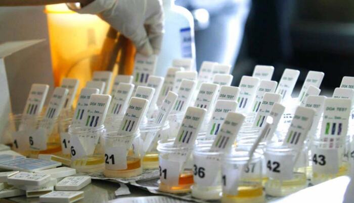 Deteksi Dini Penyalahgunaan Narkoba, Personel Polres Serang Kota Dites Urine