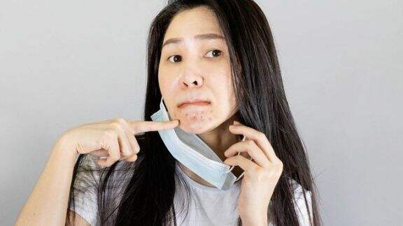 Suntik Jerawat Jadi Treatment Alternatif? Ini Lho Efek Sampingnya...