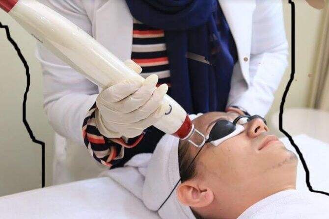 Ingin Hilangkan Tato dan Bekas Luka, Cobalah Terapi Laser