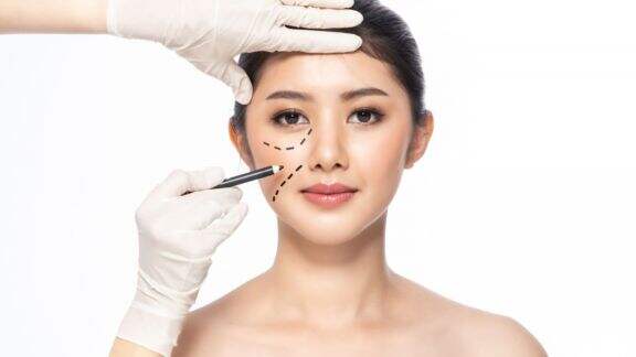 Botox Bisa Atasi Depresi? Begini Lho Penjelasannya...